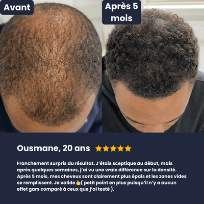 Le roll-on qui cible tes golfes en 60 secondes par jour