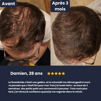 Le roll-on qui cible tes golfes en 60 secondes par jour